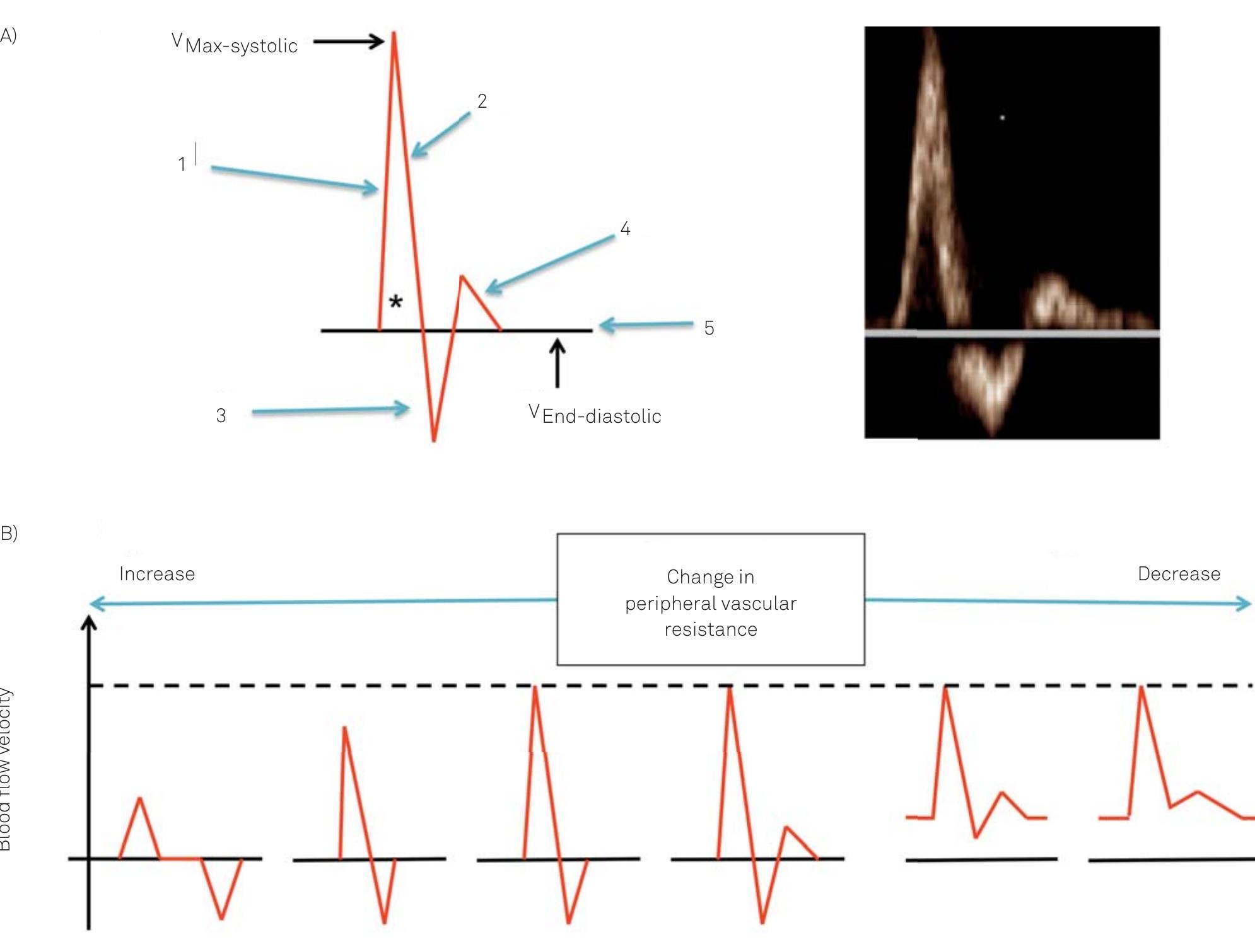 (PDF) Statement for Doppler waveforms analysis