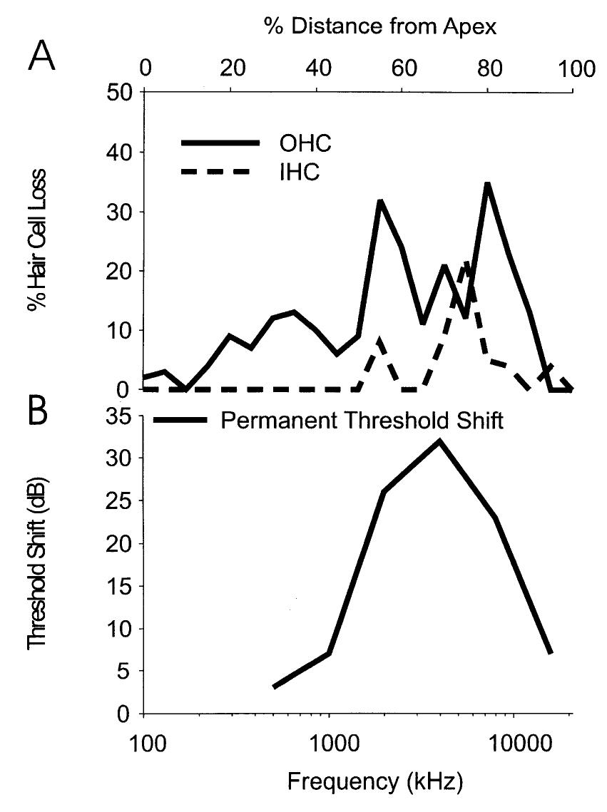 (a) schematic illustrating auditory nerve fiber tuning