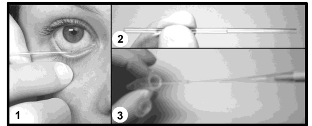 Capillary Tube Method Figure 2 - from Schirmer strip vs. capillary tube method: