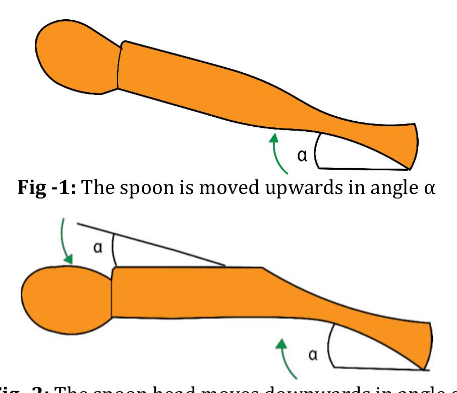 (PDF) IRJET- A Self Stabilizing Spoon for Parkinson's Patients, with ...