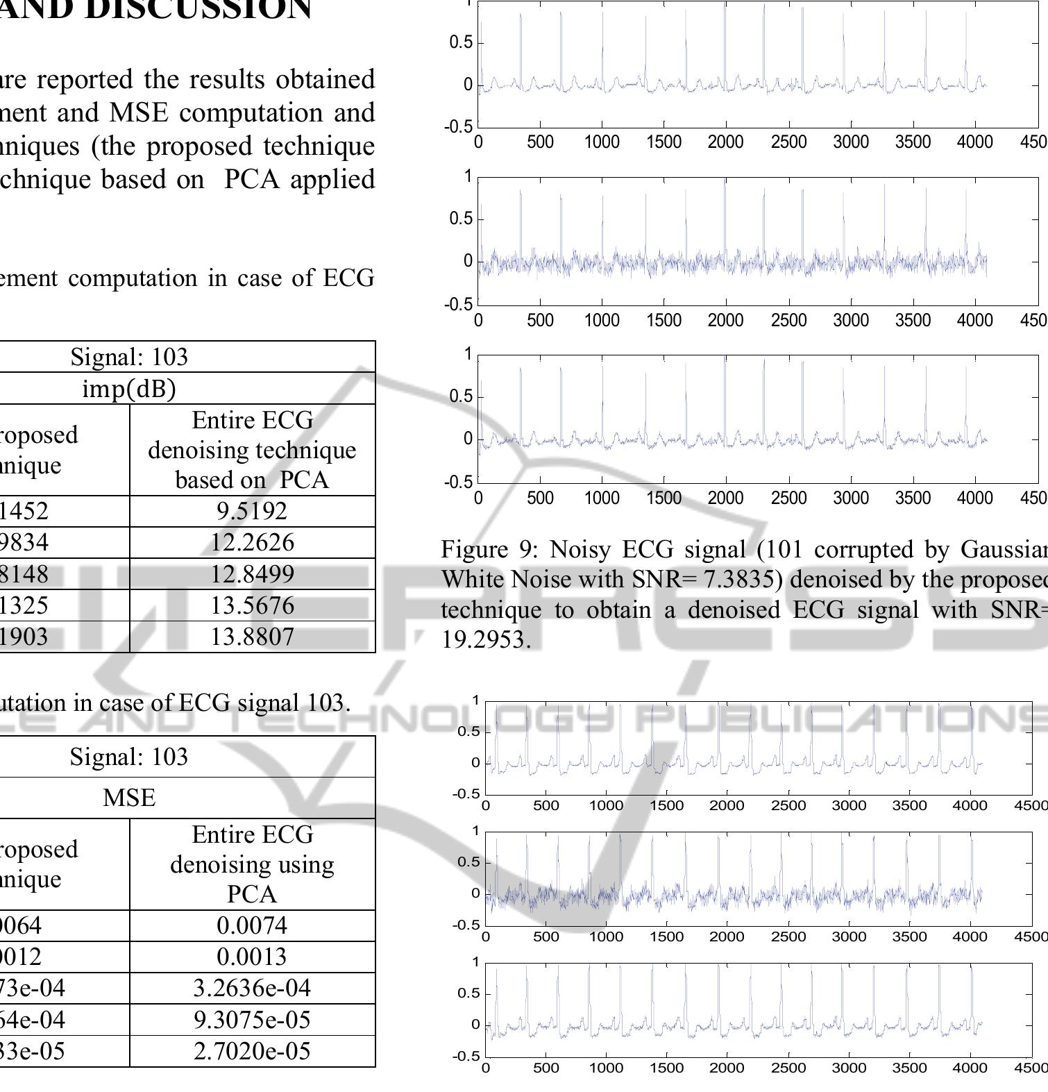 (PDF) ECG Denoising based on PCA and using R Peaks Detection