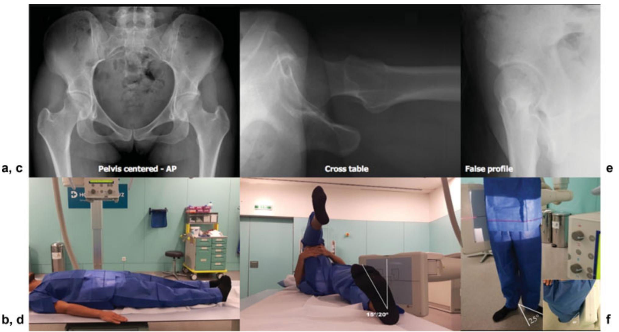 Figure 12 - from Imaging Methodology for Hip Preservation: