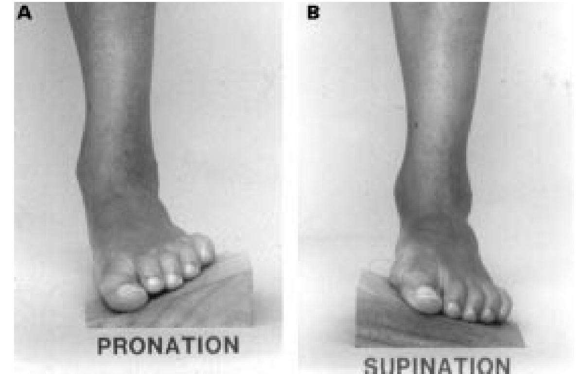 (PDF) The foot in sport