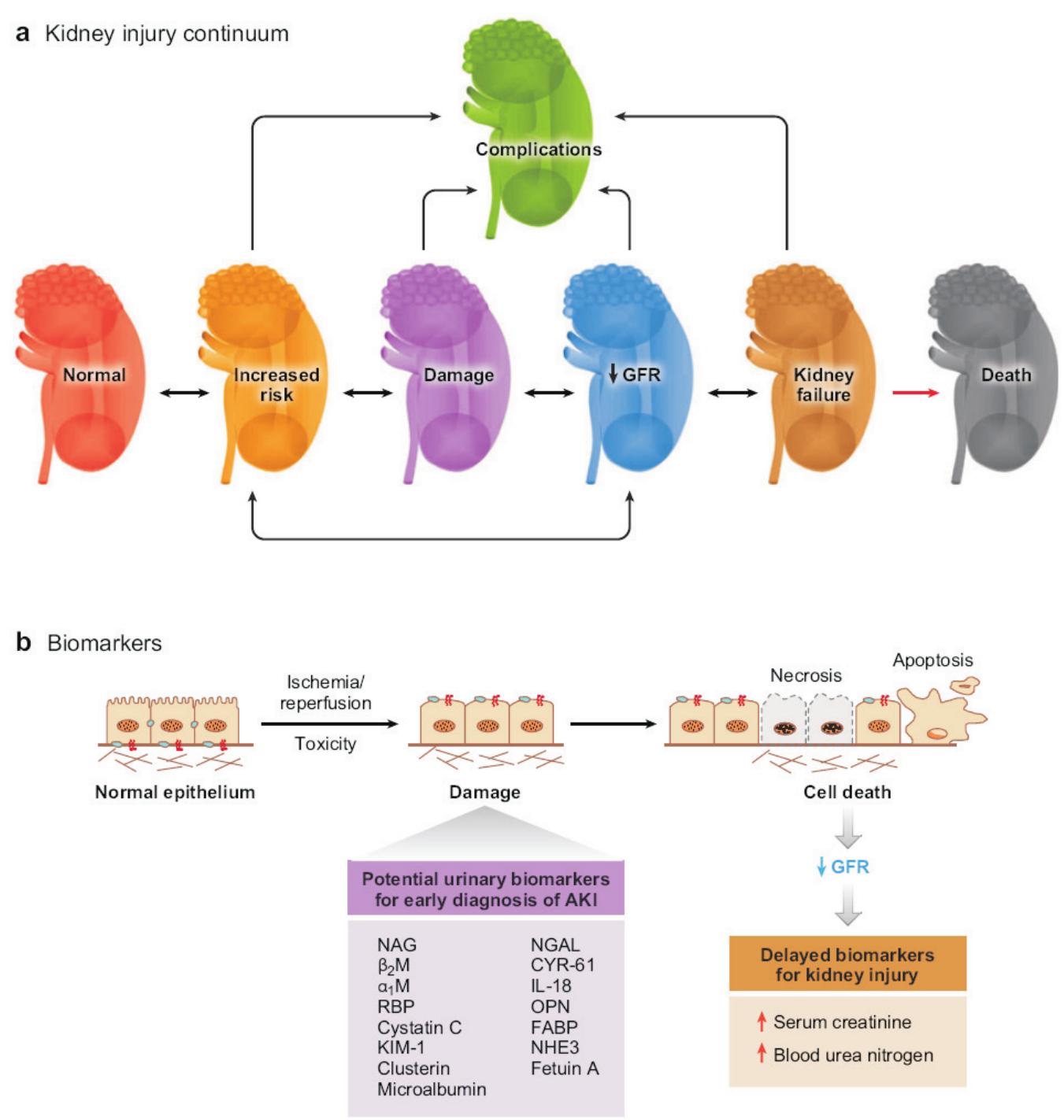 Kidney injury continuum and biomarker roles®