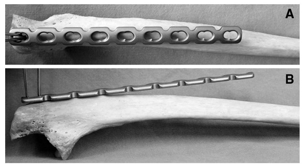 Ulna Varus (PDF) Proximal ulna morphometry: which are the “true” anatomical ...