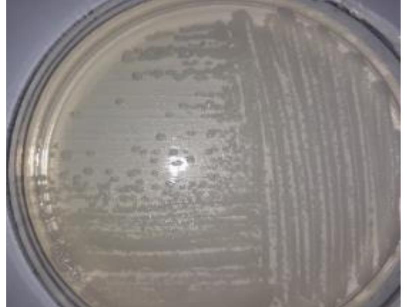 Api Bacilus Figure 1 - from Preliminary characterisation of Bacillus
