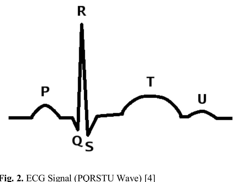 Figure 4 - from Development of Electrocardiograph Monitoring