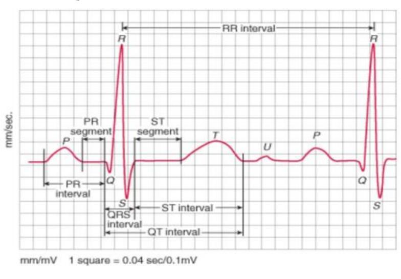 Labview Ecg (PDF) Labview Based Ecg Signal Acquisition and Analysis