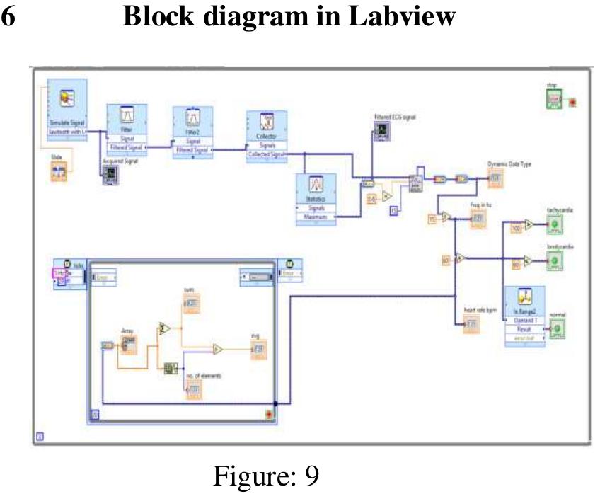 Labview Ecg (PDF) Labview Based Ecg Signal Acquisition and Analysis