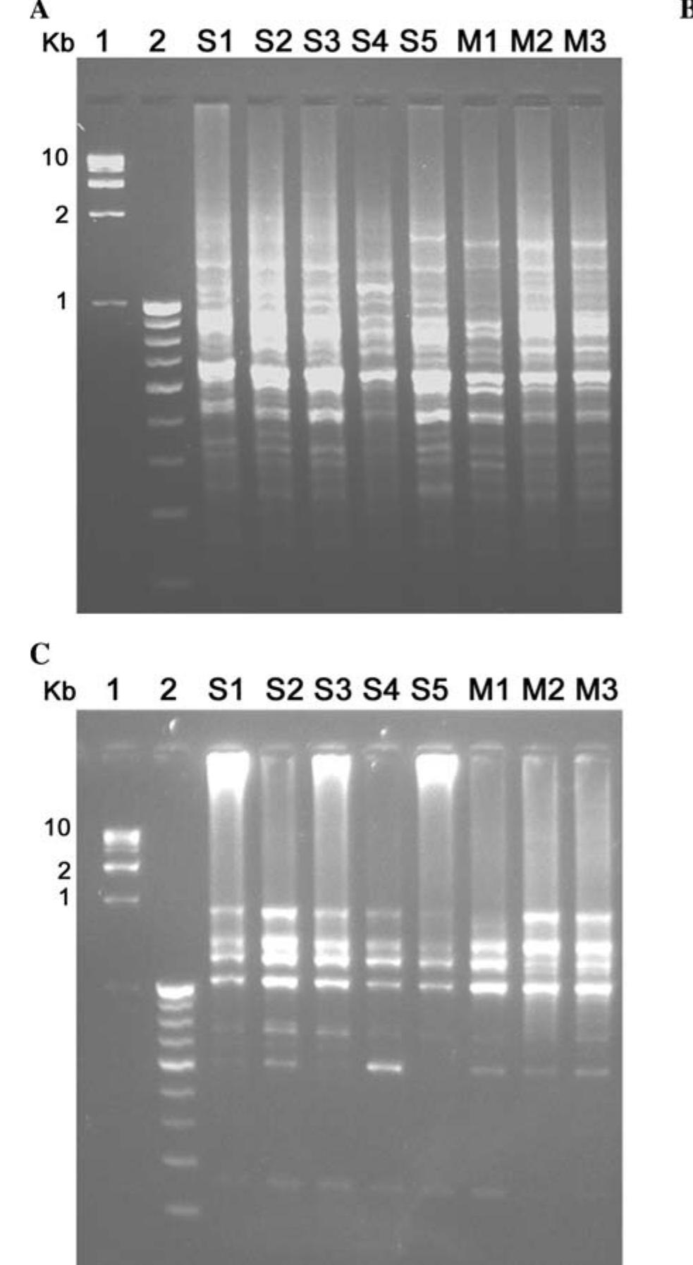 Agarose gel electrophoresis of pcr-amplified products from