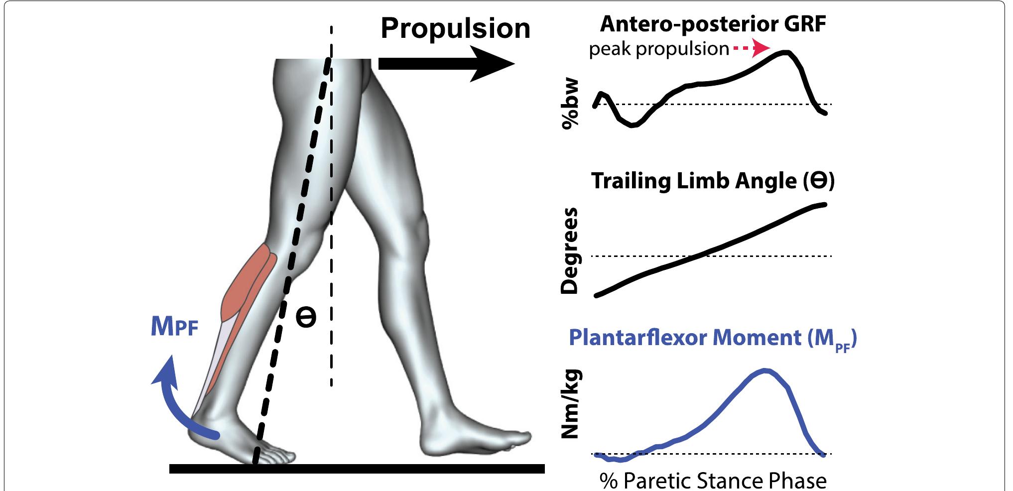 (PDF) These legs were made for propulsion: advancing the diagnosis and ...