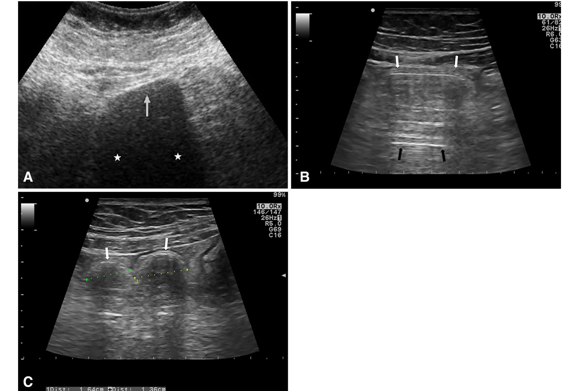 (PDF) Body packing: a review of general background, clinical and ...