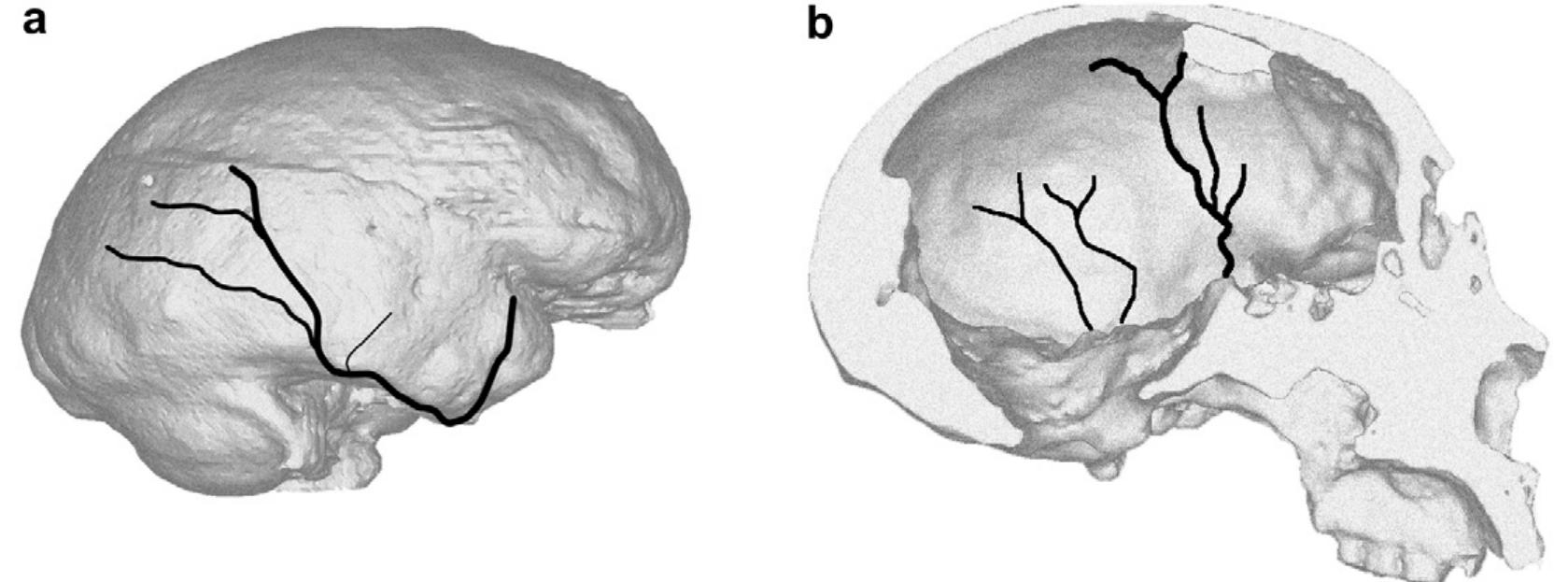 Figure 6 - from Paleoneurology of an “early” Neandertal: