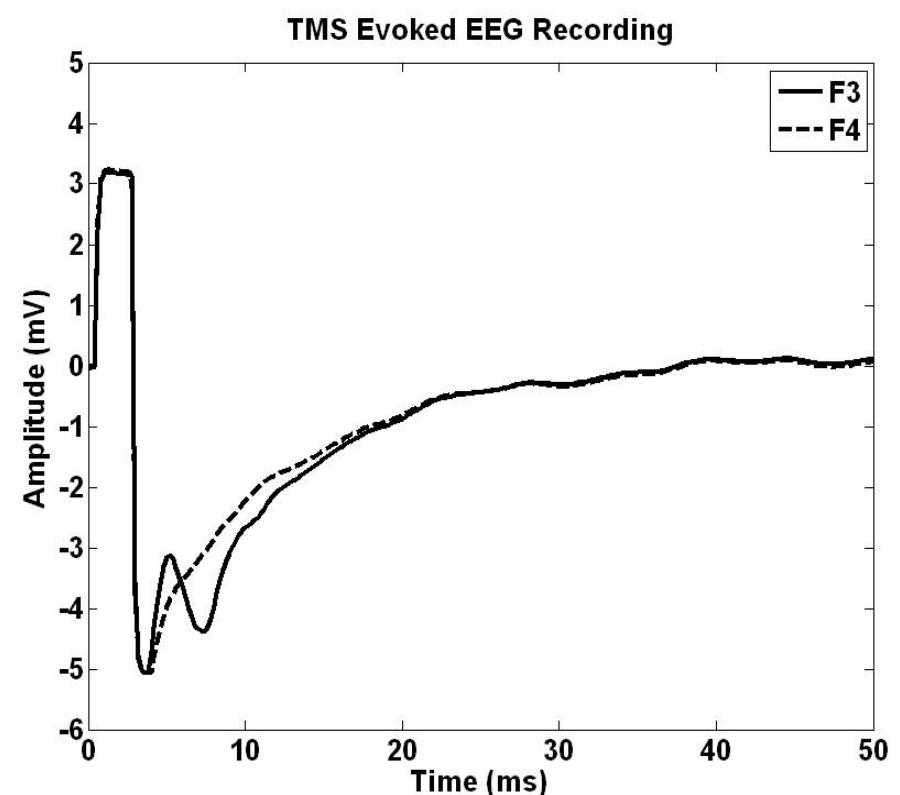 Eeg responses for medial left frontal lobe stimulation at f3