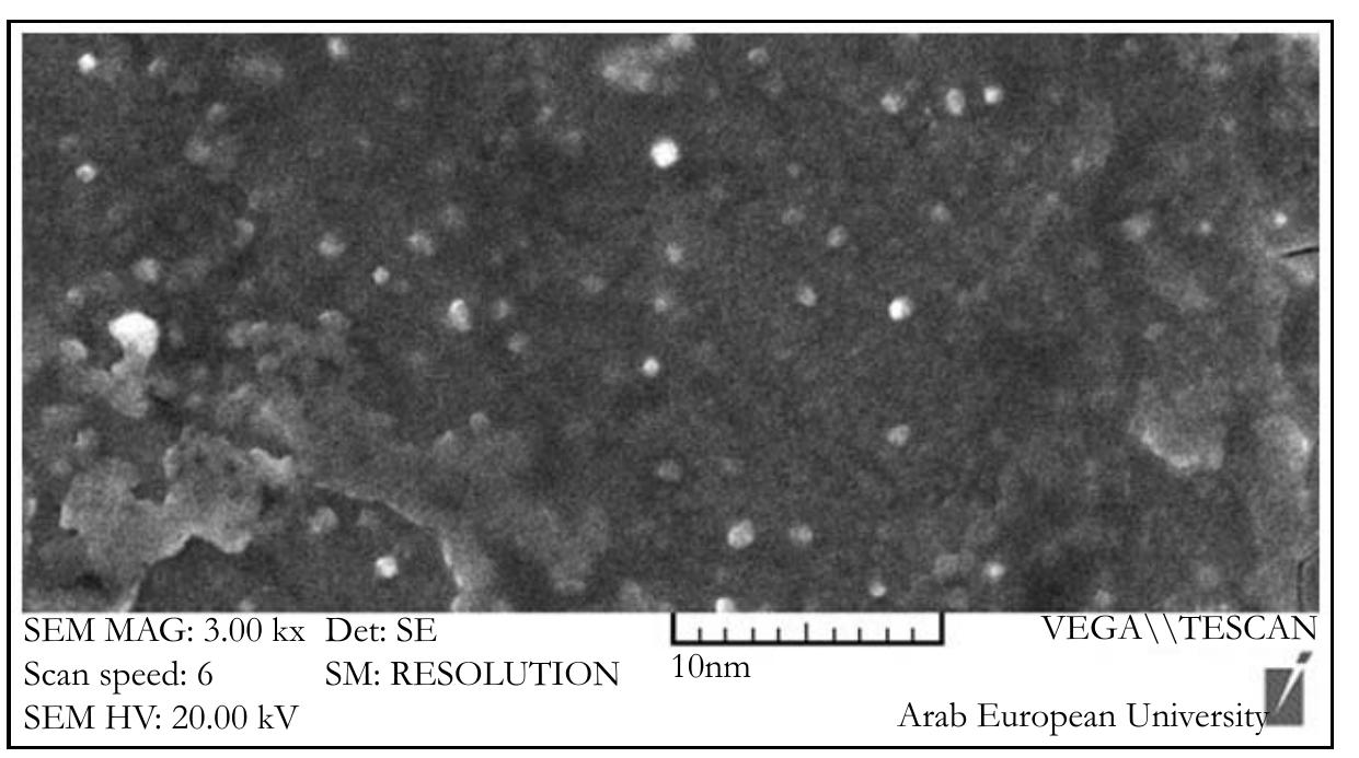 Scanning electron microscopy showing shape and size of the