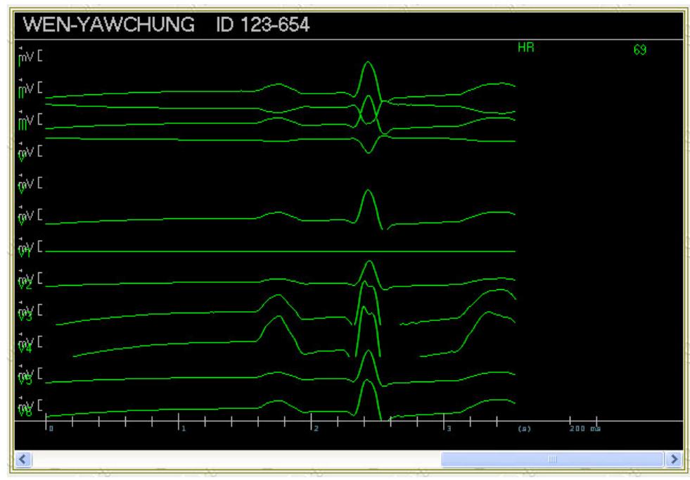 (PDF) DICOM Waveform Generator