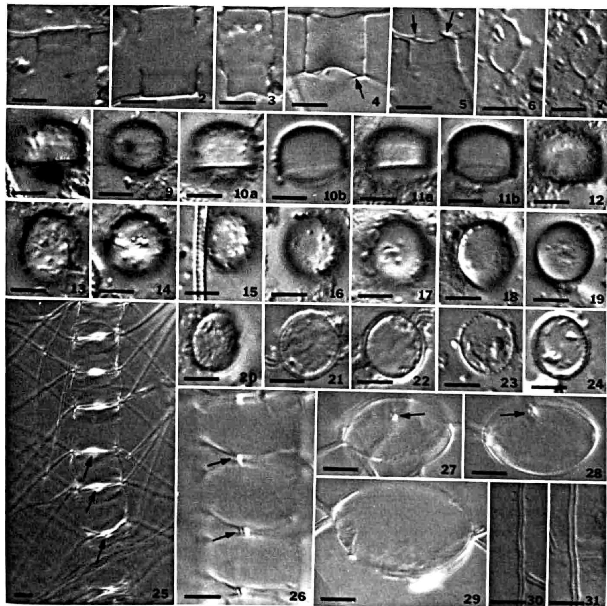 (PDF) The Inland Chaetoceros (Bacillariophyceae) Species of North America