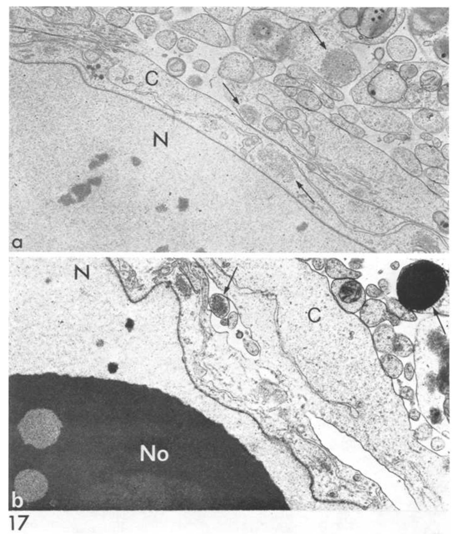 Perinuclear Inclusions (PDF) Morphology of the nucleo-cytoplasmic interactions during the ...