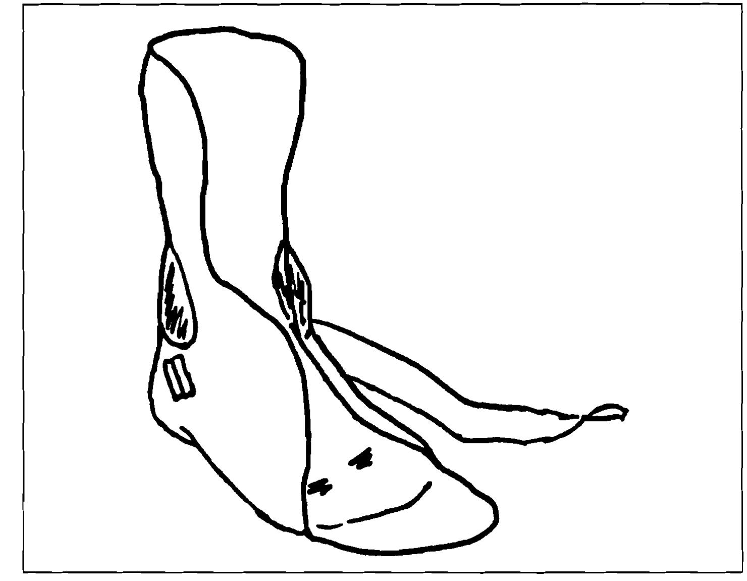 (PDF) Effect of a Tone-Inhibiting Dynamic Ankle-Foot Orthosis on the ...