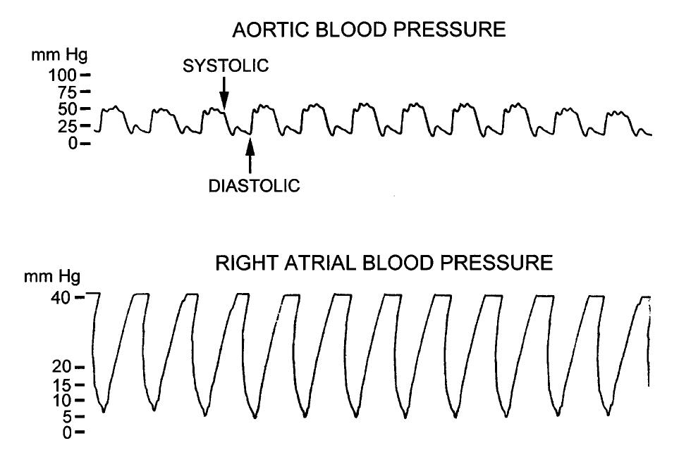Figure 3 - from Utstein-style guidelines for uniform