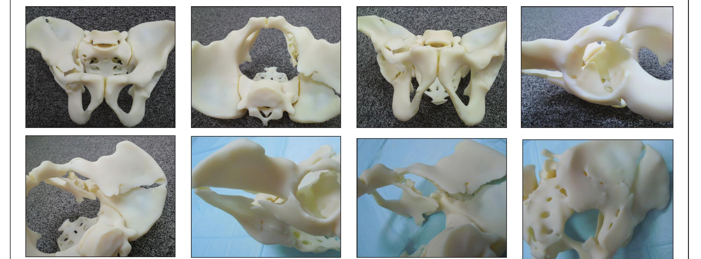 Figure 3 - from Tactile surgical navigation system for