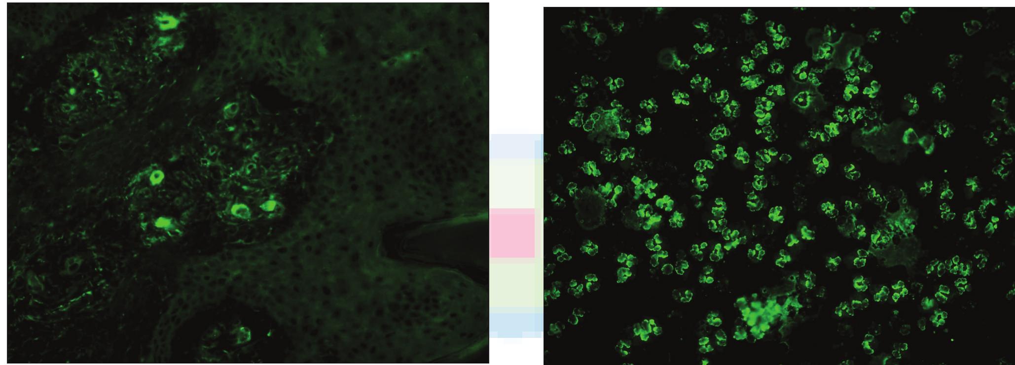 (PDF) Immunofluorescence in dermatology