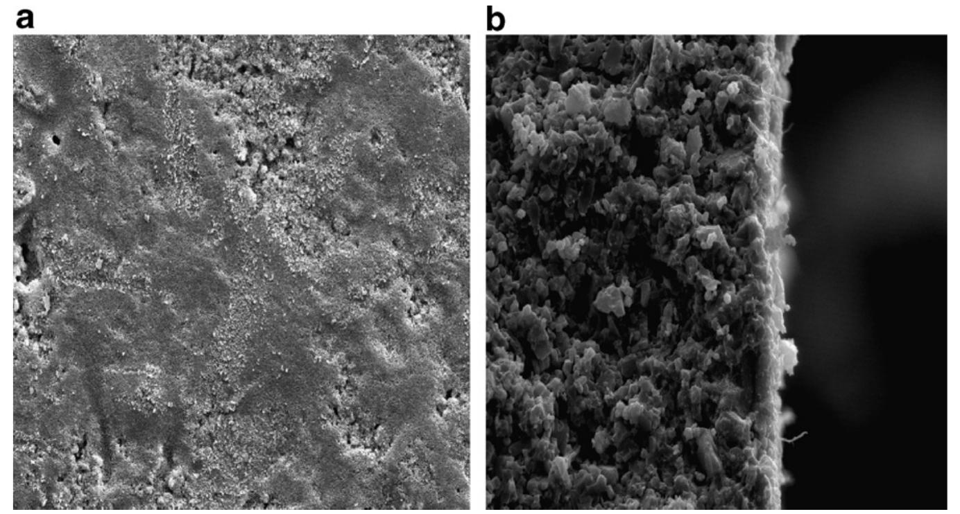 Sem pictures of (a) surface and (b) cross section of the