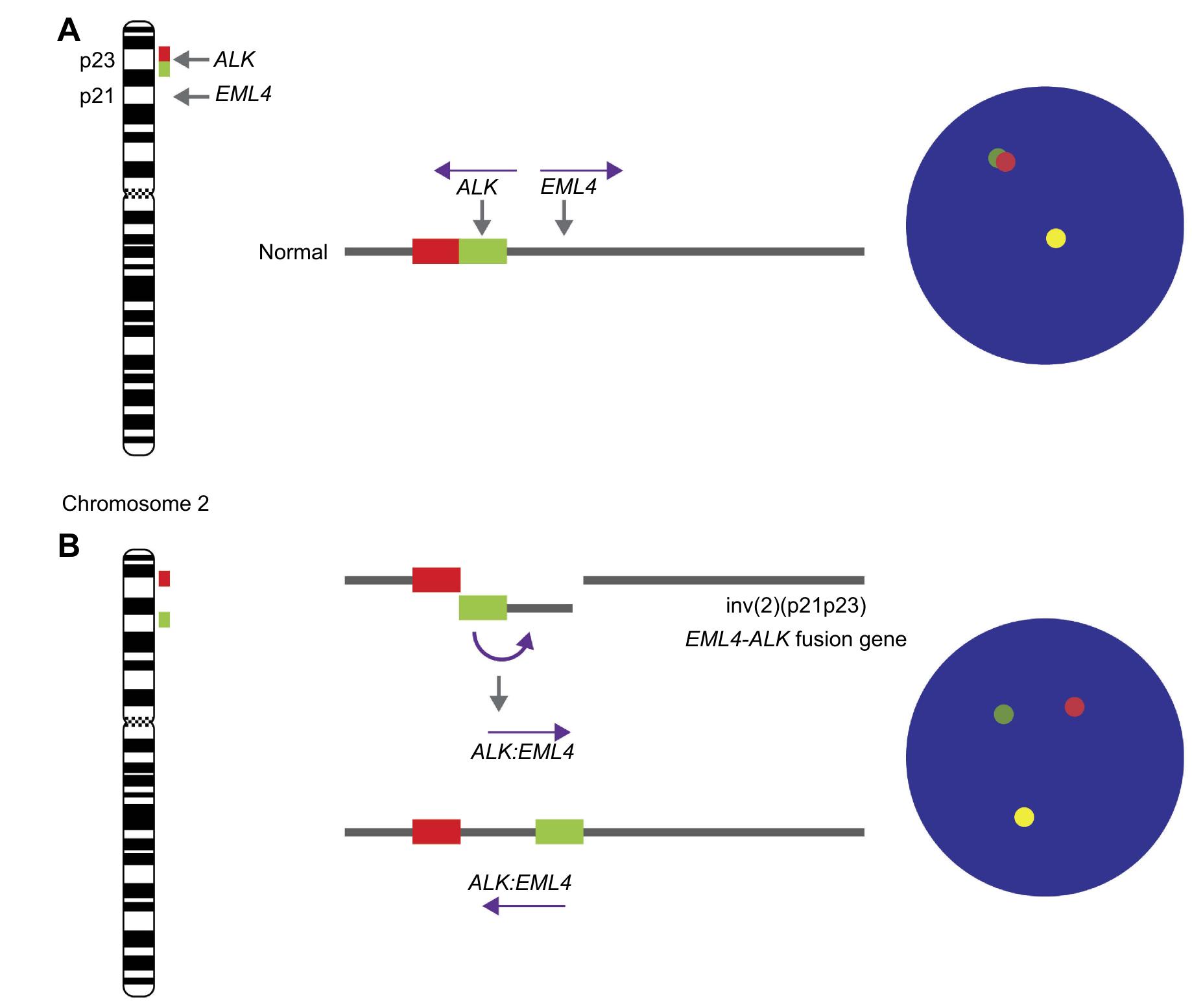 | genes commonly altered in lung and pleural diseases