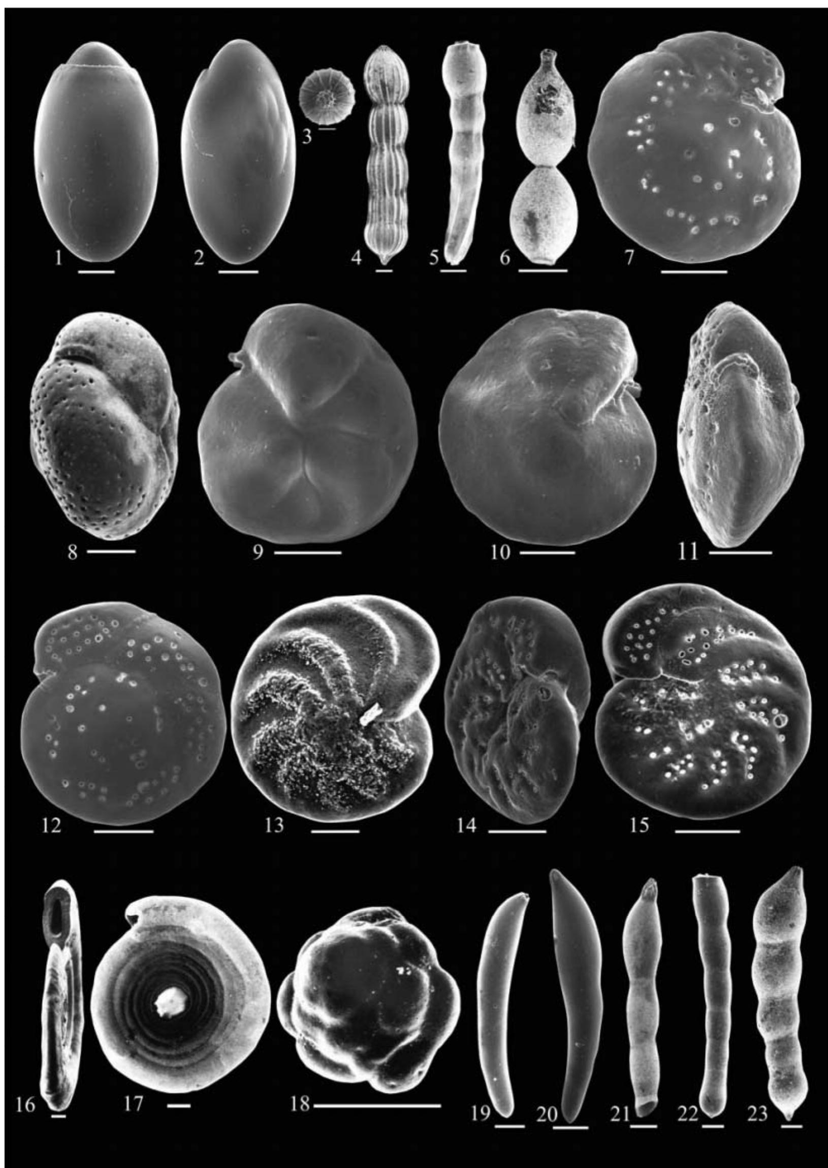 Figure 10 - Distribution of deep-sea benthic foraminifera in