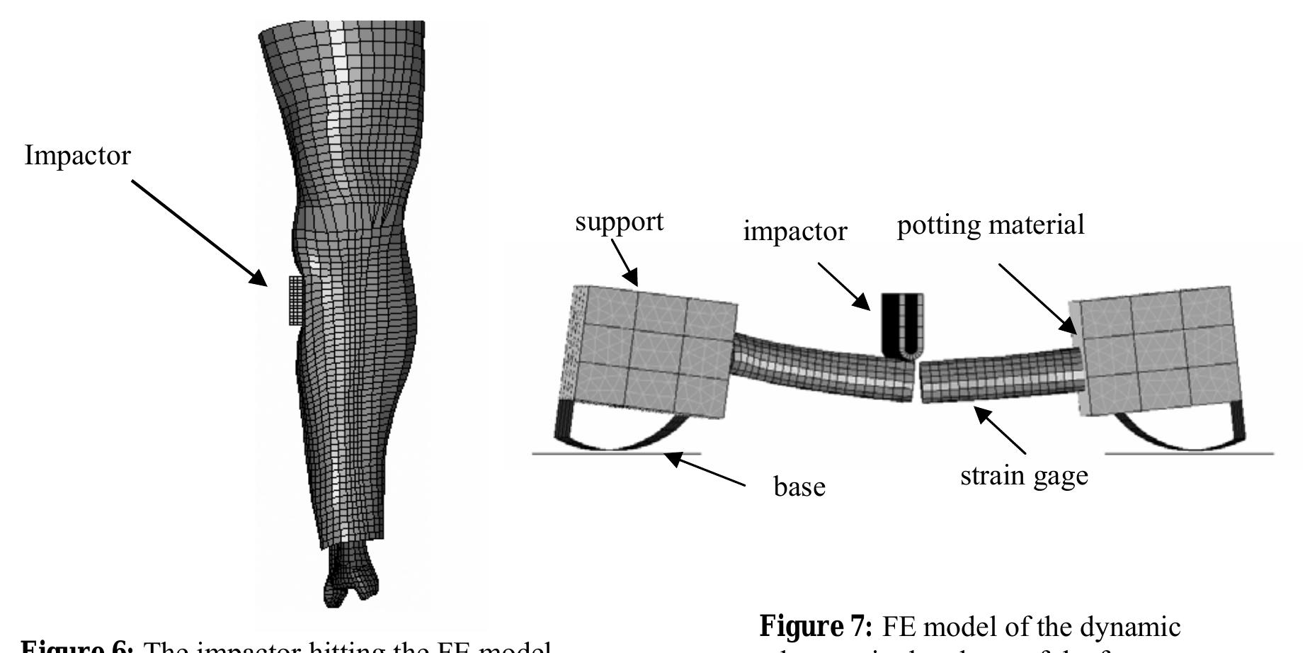 (PDF) A finite element model of the lower limb for simulating ...