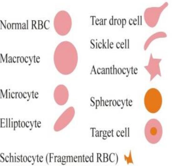 Figure 7 - from Qualitative Abnormalities of Peripheral