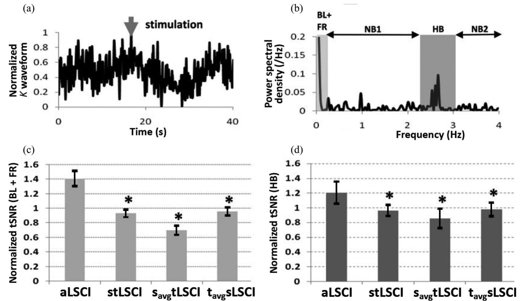 (PDF) Anisotropic Processing of Laser Speckle Images Improves ...