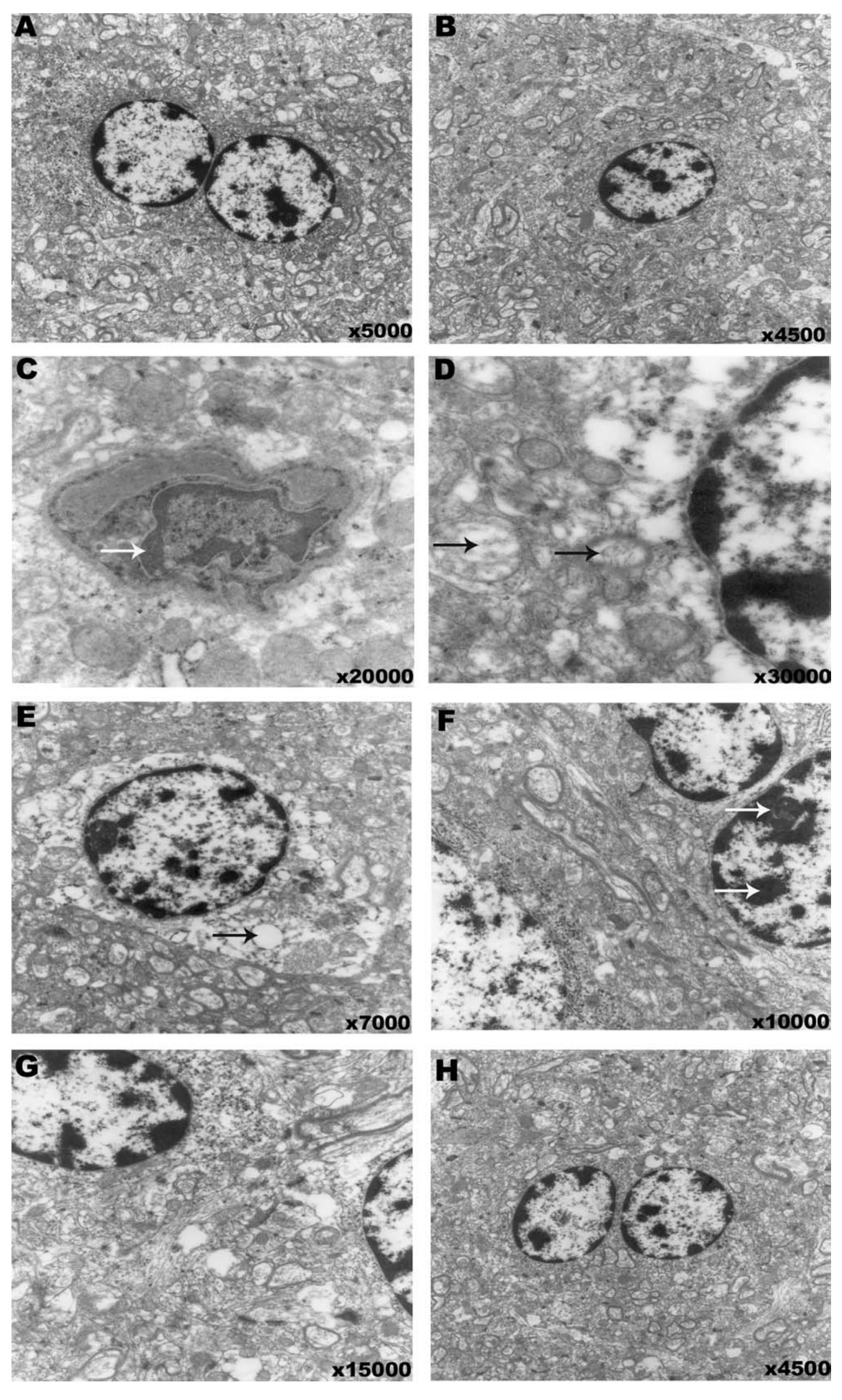 Transmission electron microscopy of cerebral cortex from