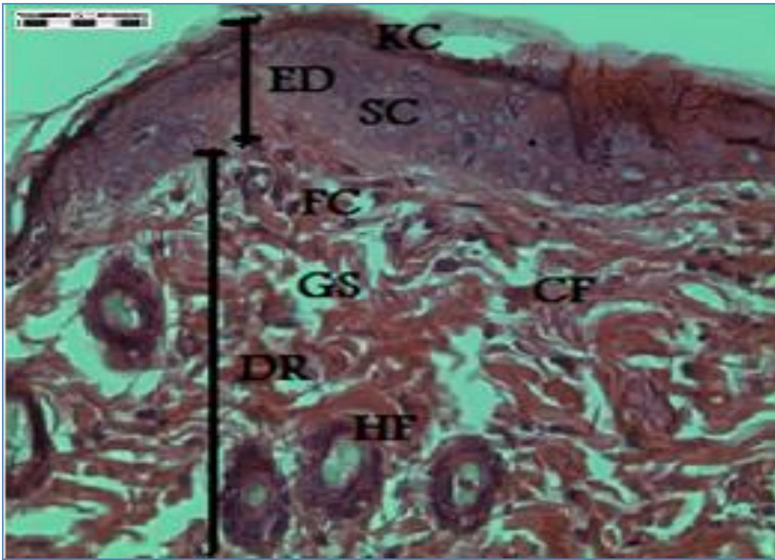 (PDF) The effects of different laser doses on skin