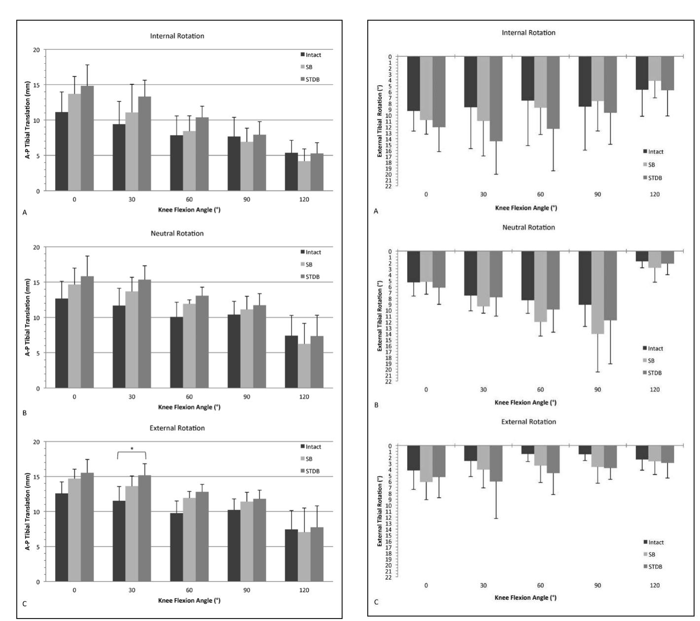 Mean coupled tibial rotation from a 150 n posterior tibial
