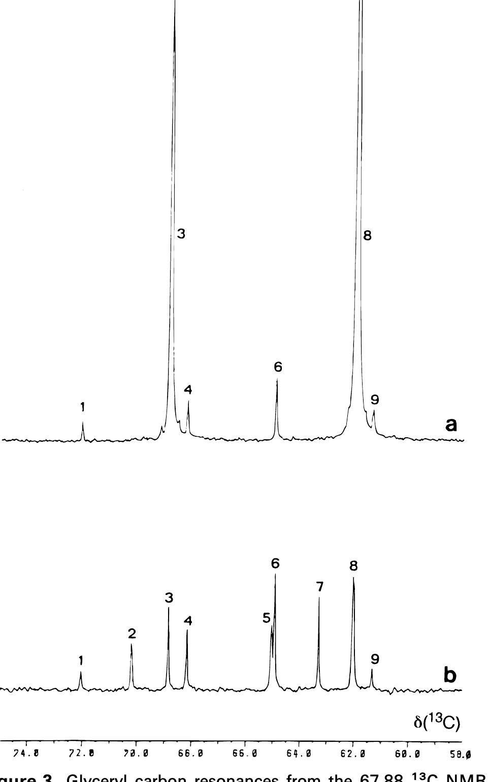 Figure 3 - 1H and 13C NMR of virgin olive oil. An overview