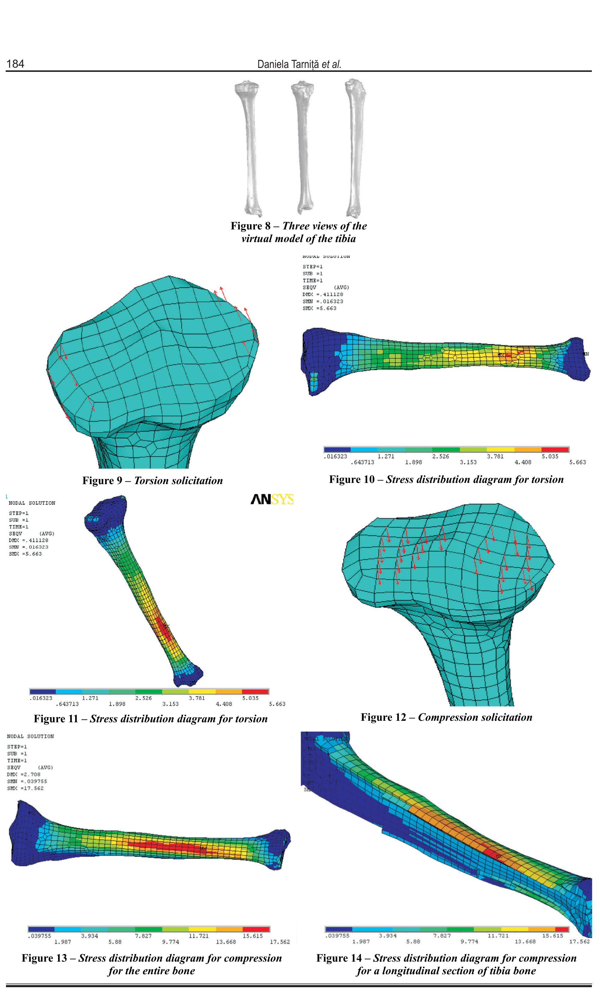 Solidworks Tibia Model (PDF) CAD method for three-dimensional model of the tibia bone and ...