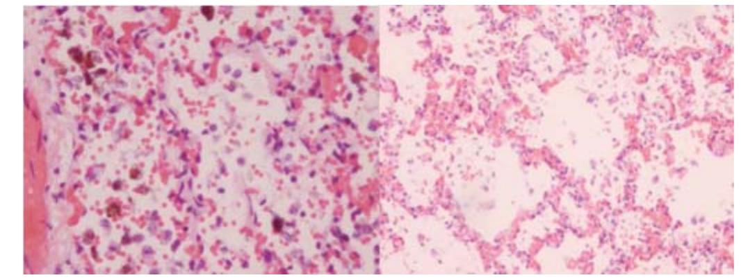 A. histology of the lung (h & e) figure 1: lung histology