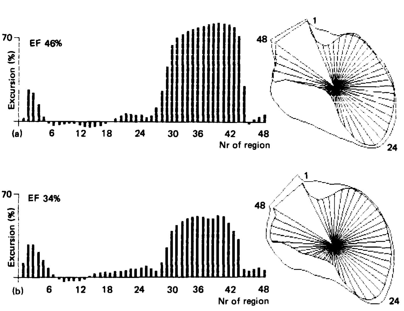 Analysis of lv regional wall motion in (a) acute and (b)