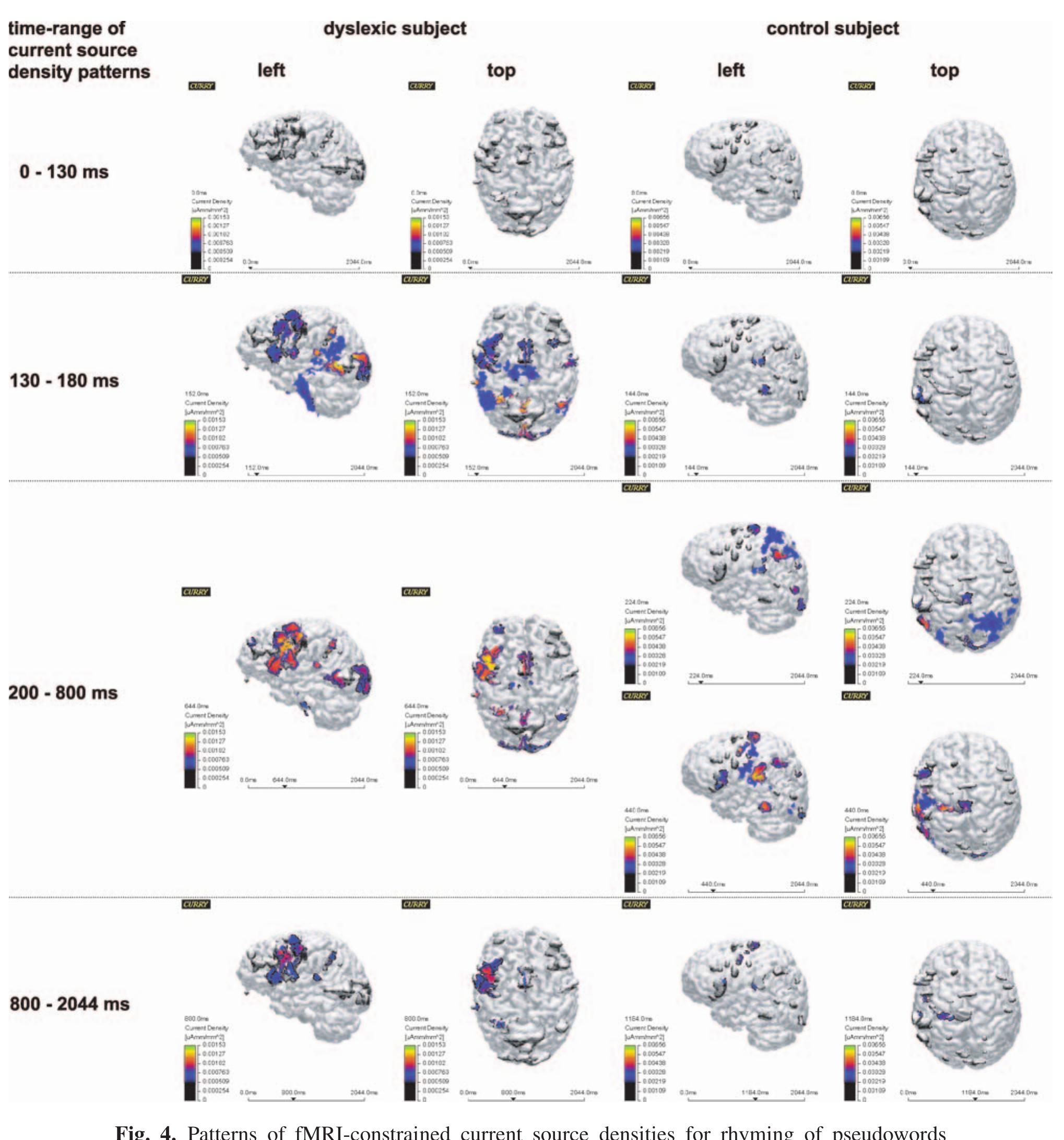 (PDF) Dyslexia: the possible benefit of multimodal integration of fMRI ...
