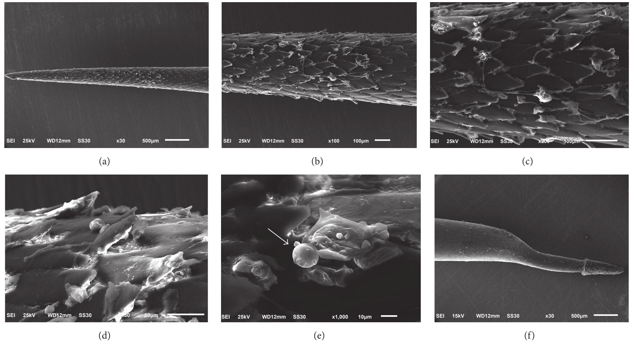 (PDF) Clinical Manifestation, Histopathology, and Imaging of Traumatic ...