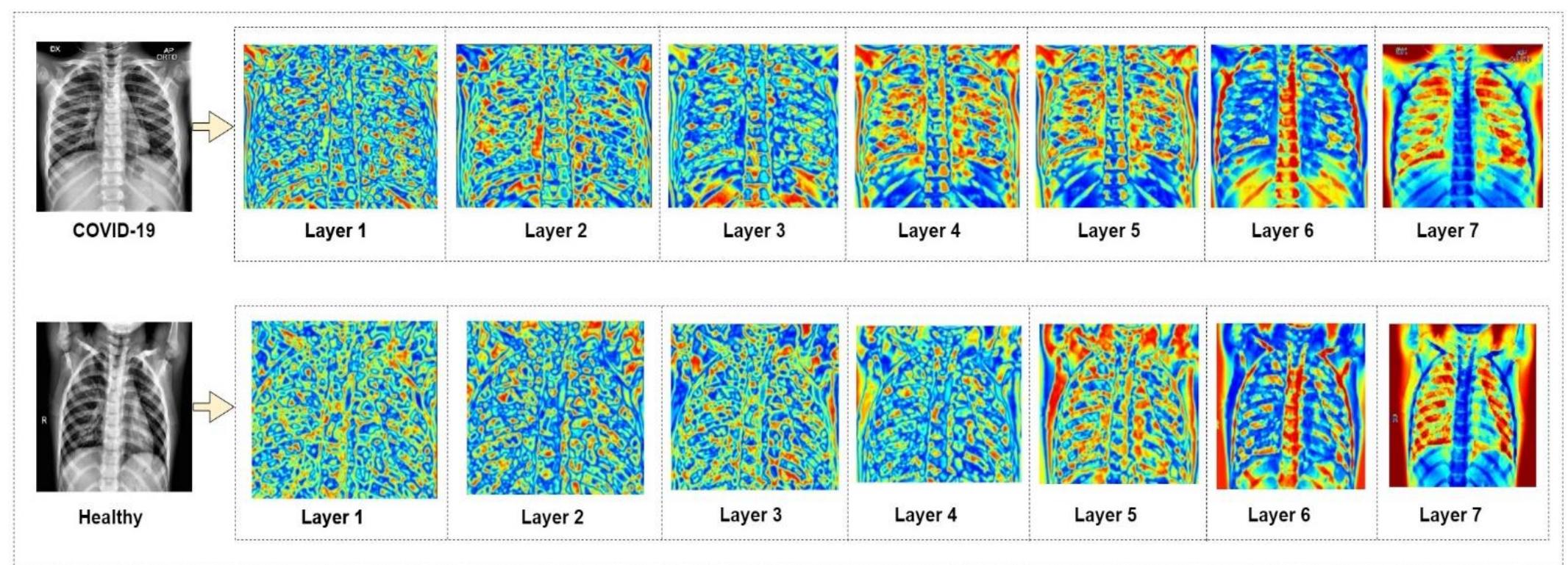 Heat map of modified mobilenetv2 classification. it is
