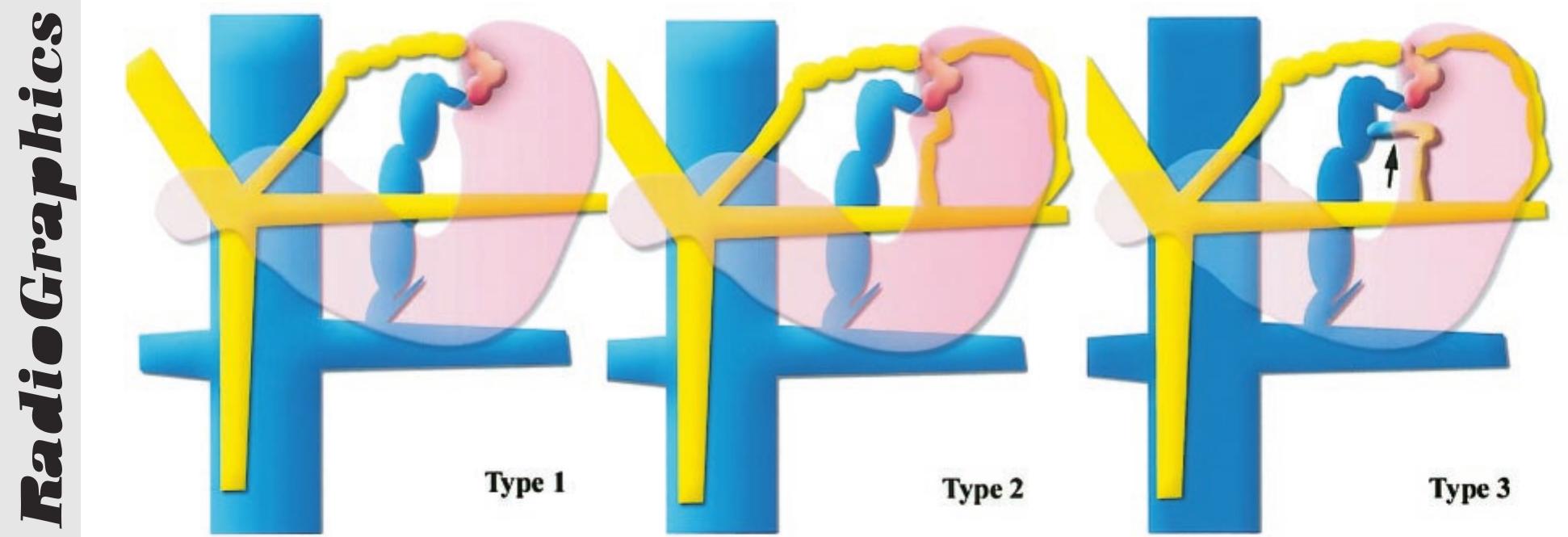 Figure 13 - from Multidetector CT Anatomy of Drainage Routes