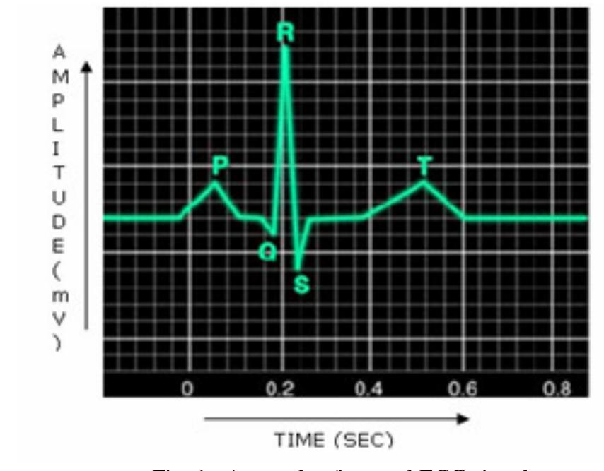 Ecg Comment Examples A sample of normal ecg signal 12 ecg entries each with 60