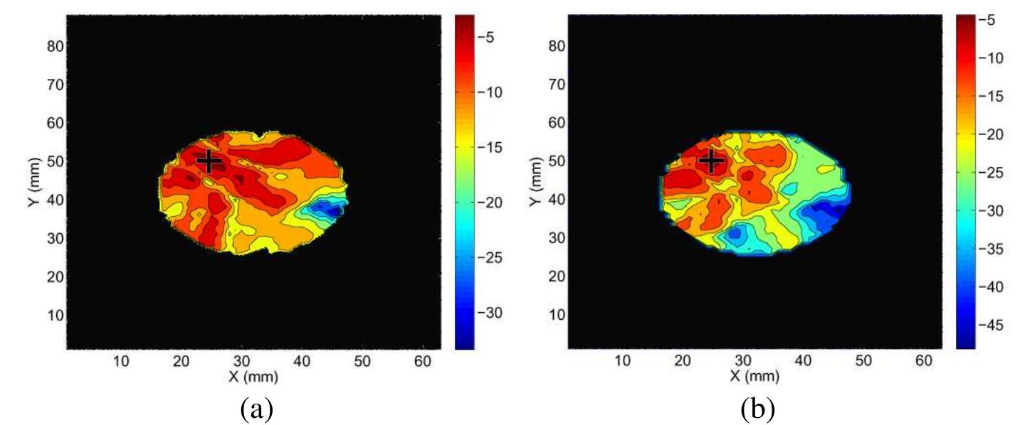 (PDF) Rotating Antenna Microwave Imaging System for Breast Cancer Detection