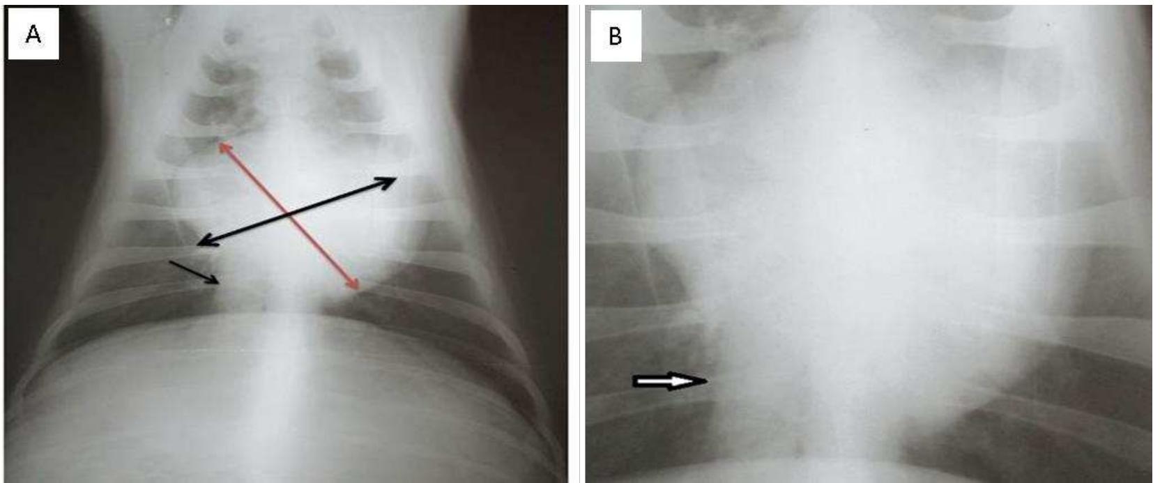 (PDF) Radiographic_Appearance_And_Measurements_Of_Thoracic_Structures ...