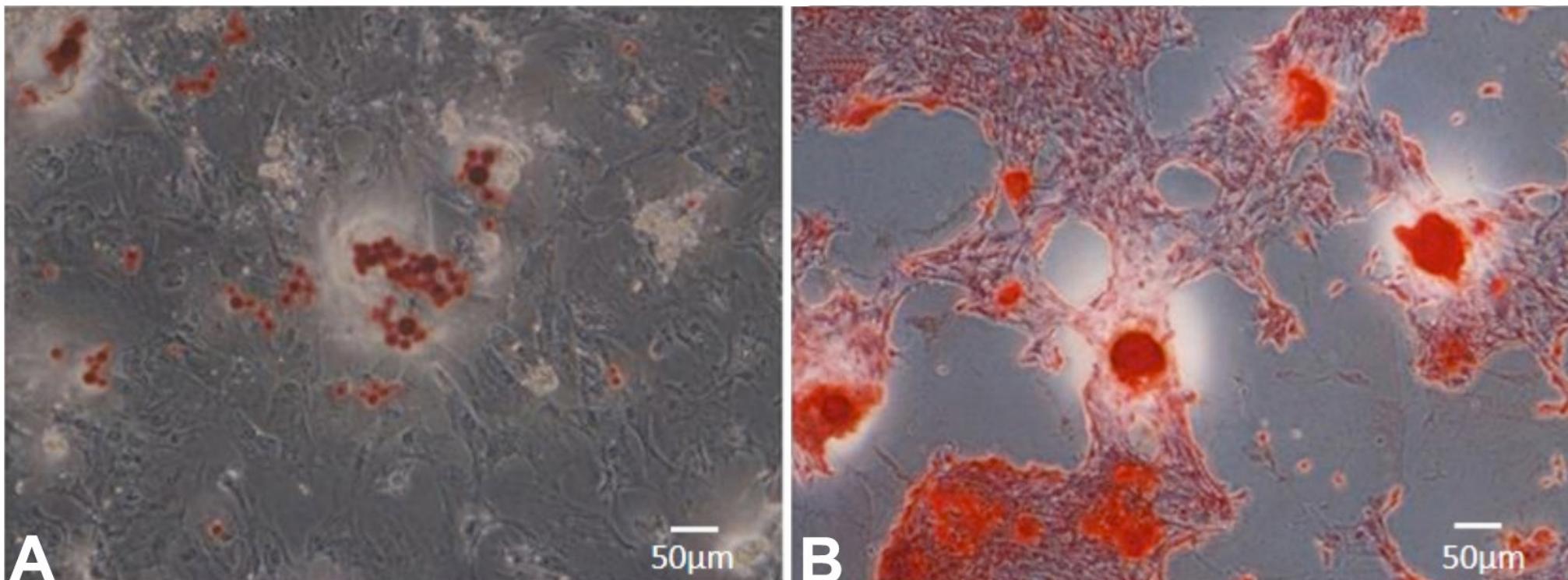 Microscopic morphology of mesenchymal stem cells derived