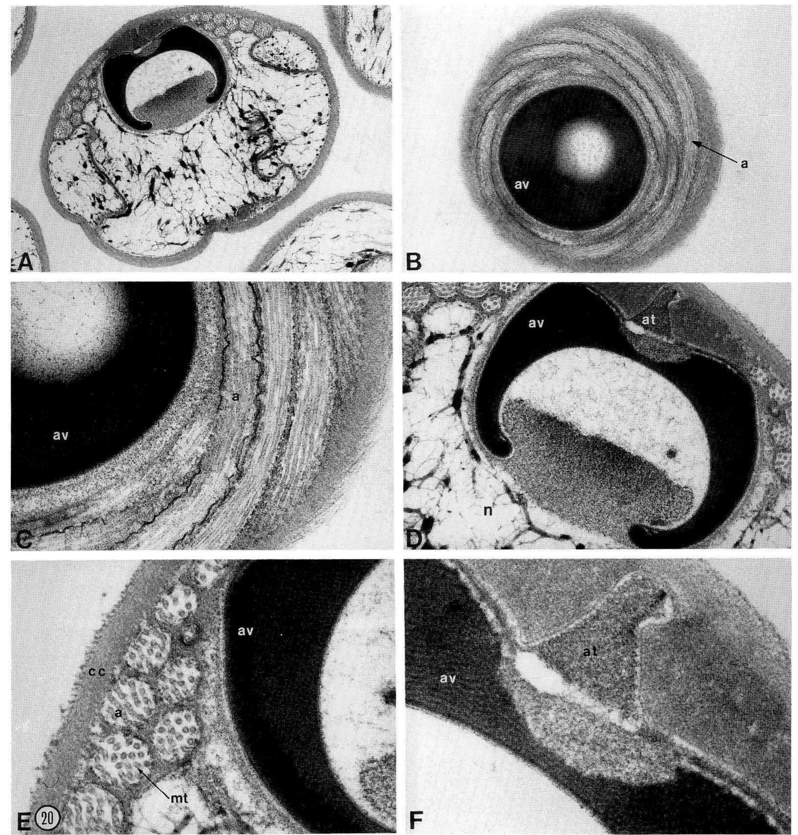 X36,000. e: close-up of acrosomal vesicle; note thick cell