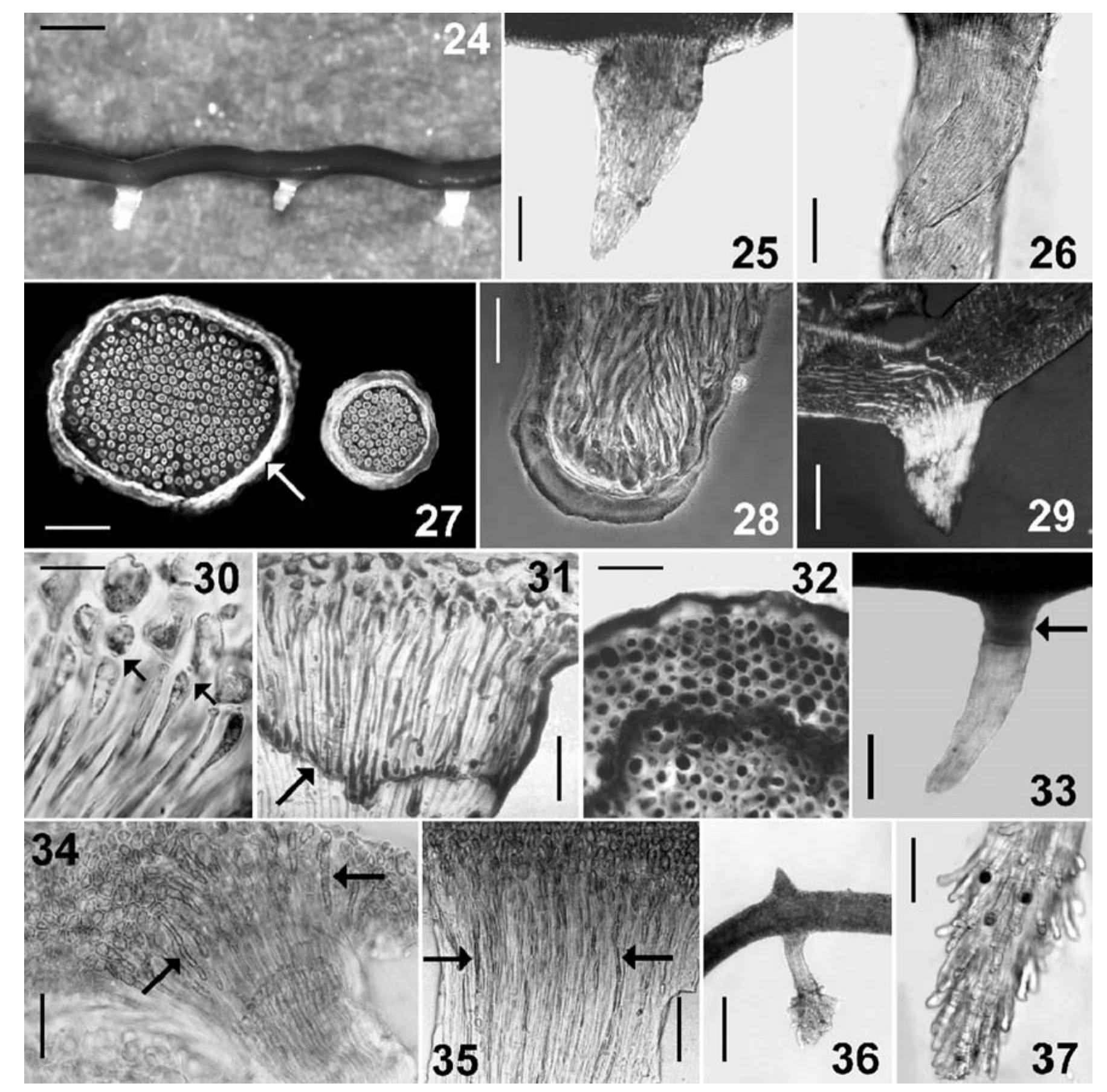 Figure 3 - from The prostrate system of the Gelidiales:
