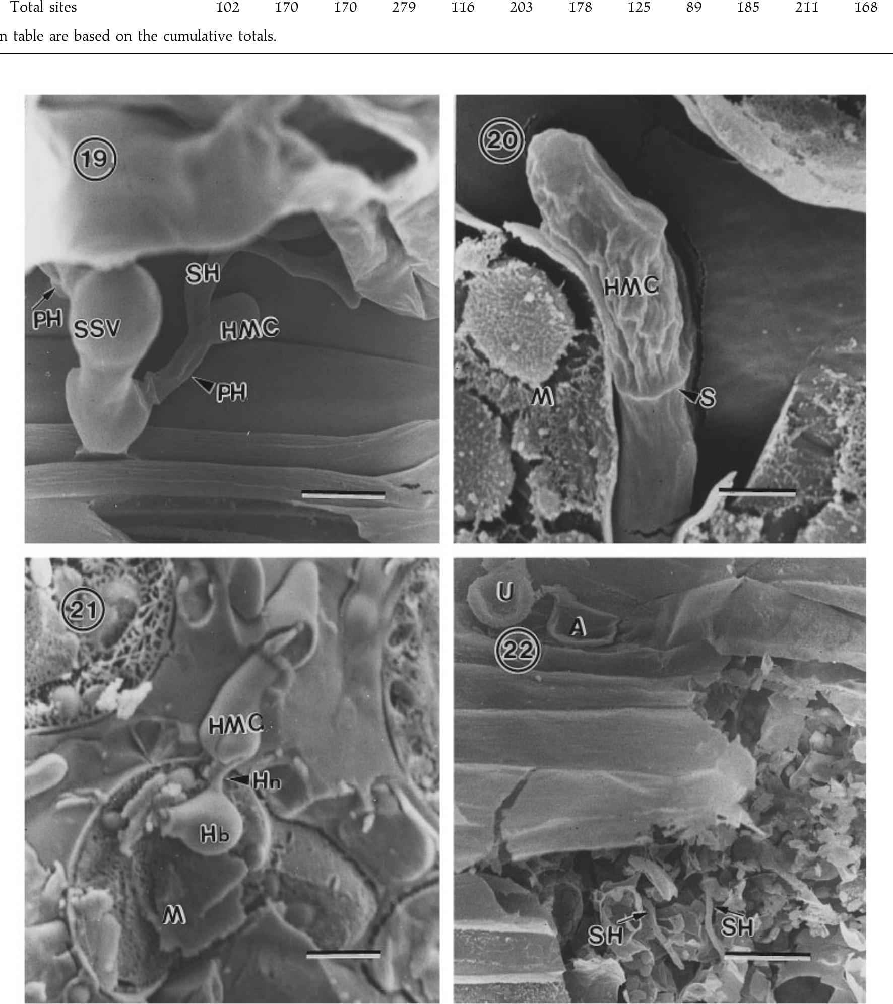 Hypha Table Figure 4 - from Scanning electron microscopy of early
